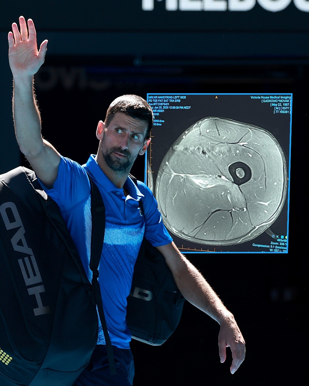 爱游戏官网-ATP总决赛轻取法网，德约科维奇高光表现